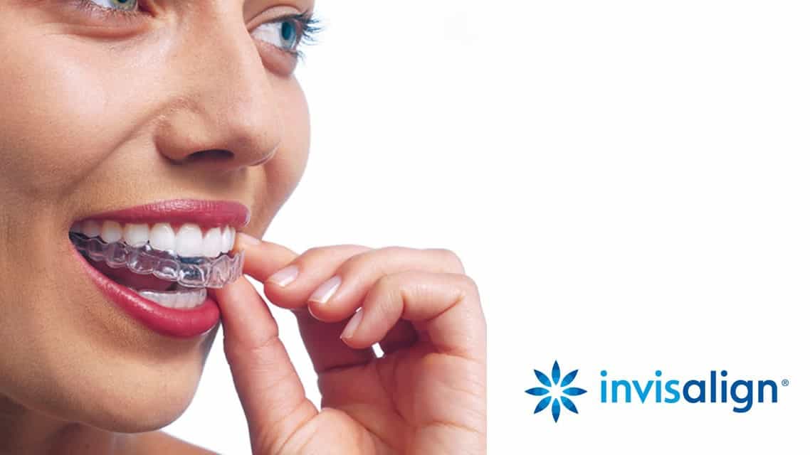 niềng răng trong suốt Invisalign tại Parkway