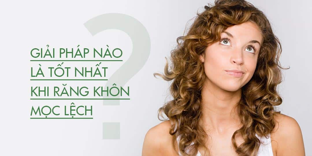 Các Trường Hợp Răng Khôn Mọc Lệch Và Hướng Xử Lý
