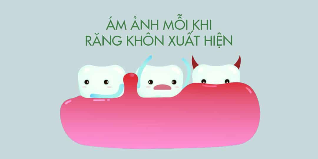 Triệu Chứng Mọc Răng Khôn