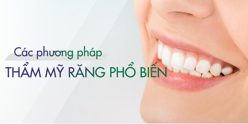 Các Phương Pháp Thẩm Mỹ Răng Phổ Biến