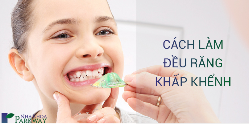 Răng Khấp Khểnh Chữa Như Thế Nào?