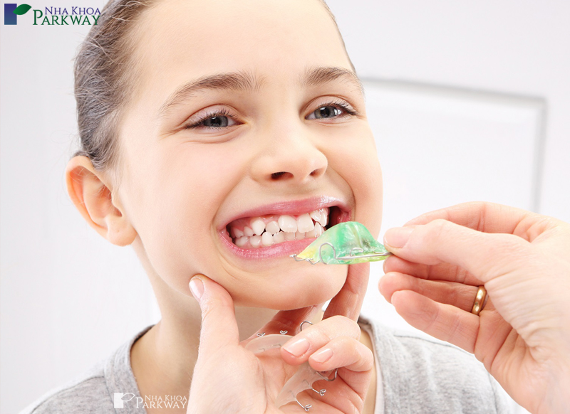 Chữa răng khấp khểnh bằng Invisalign tại nha khoa Parkway