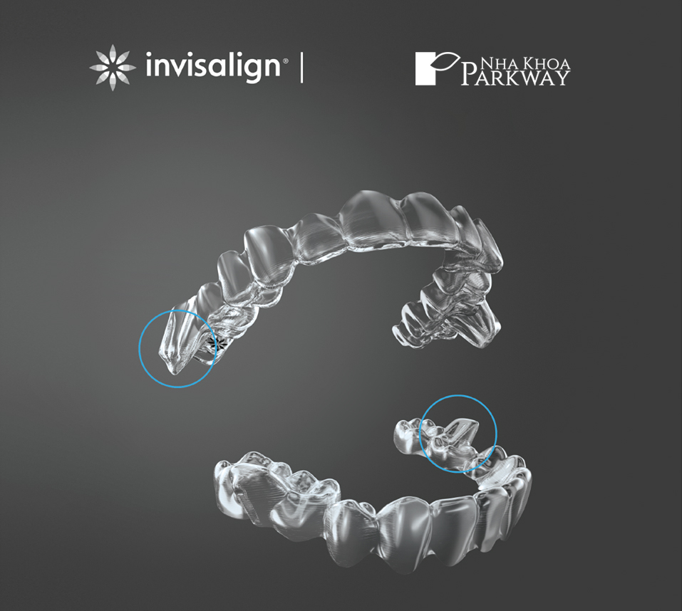 ưu điểm của niềng răng Invisalign tại nha khoa Parkway