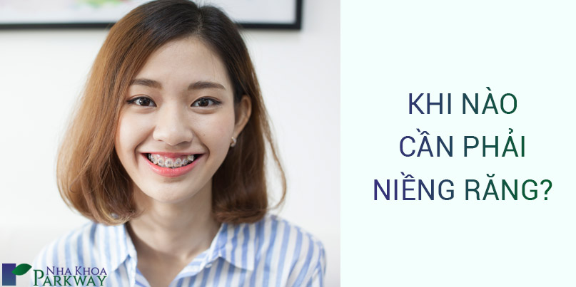 6 Trường Hợp Bắt Buộc Phải Niềng Răng