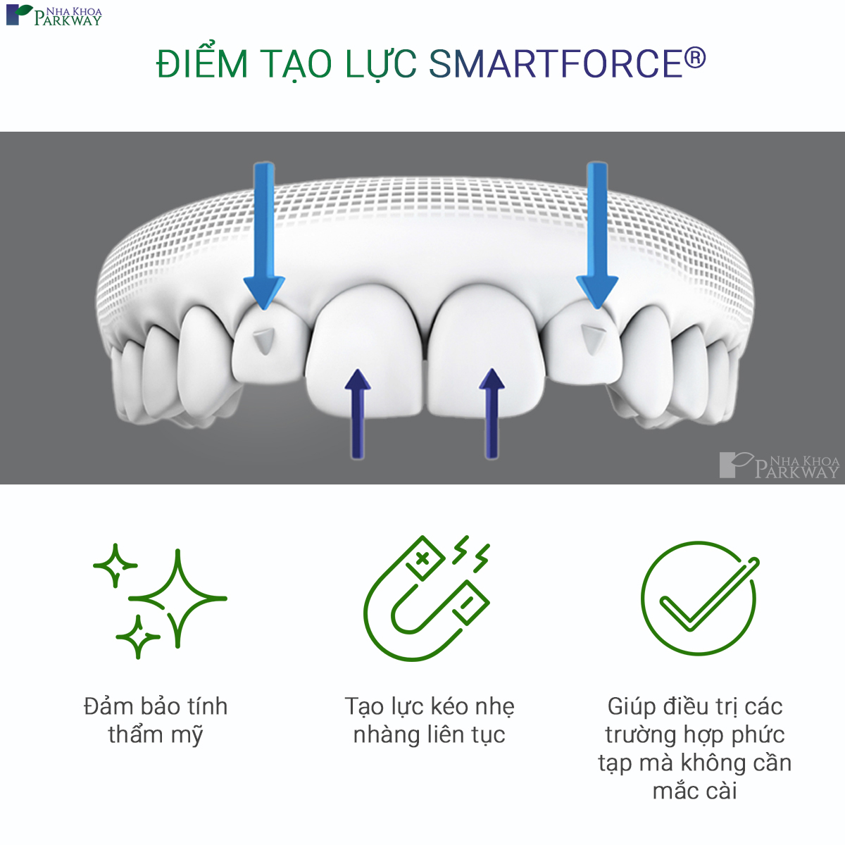 công nghệ smartforce của công nghệ niềng răng invisalign tại nha khoa parkway