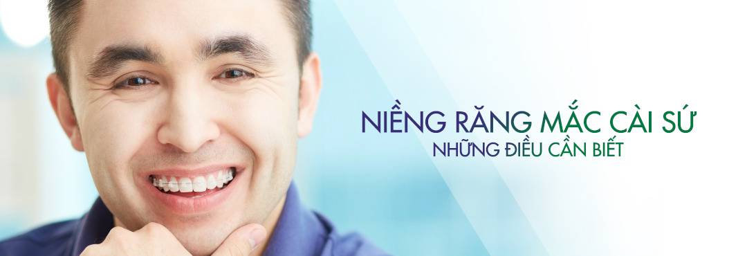 niềng răng mắc cài sứ nha khoa parkway