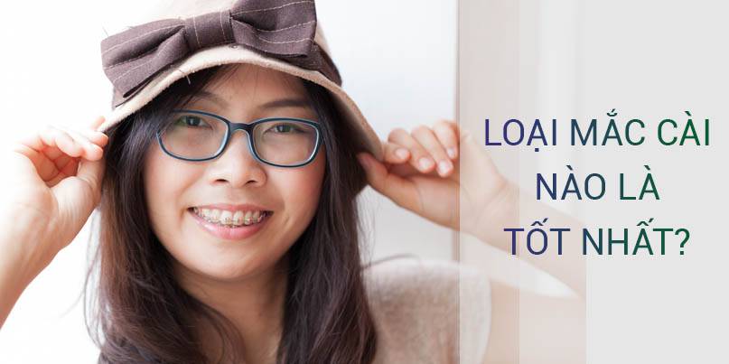 So Sánh Các Phương Pháp Niềng Răng Mắc Cài