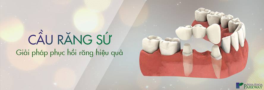 cầu răng sứ bọc răng sứ nha khoa parkway