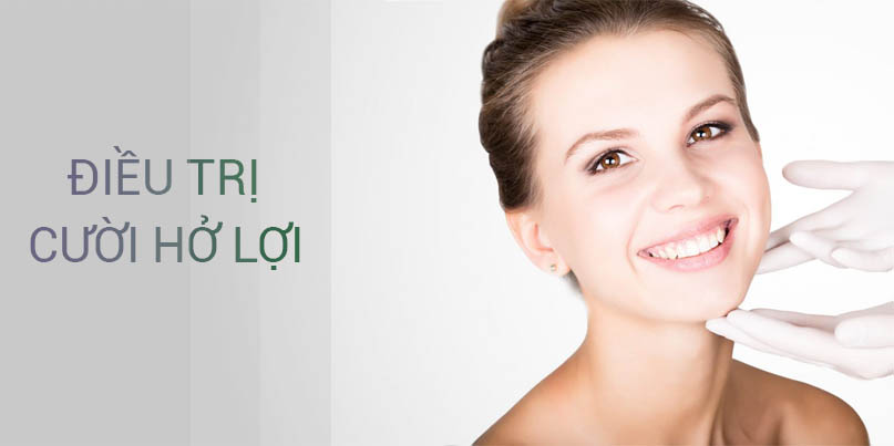 Điều trị cười hở lợi