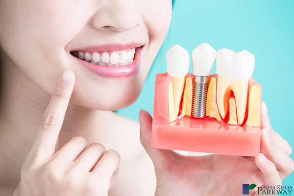 trồng răng Implant có đau không trồng răng implant nha khoa parkway