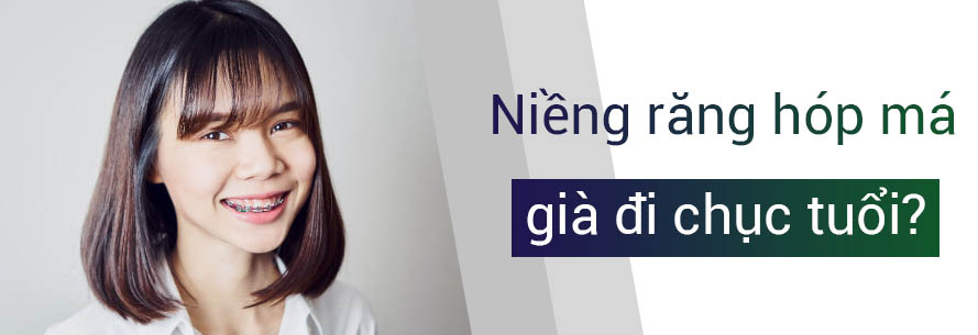 niềng răng hóp má
