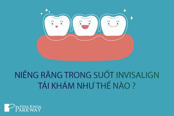 tái khám niềng răng trong suốt
