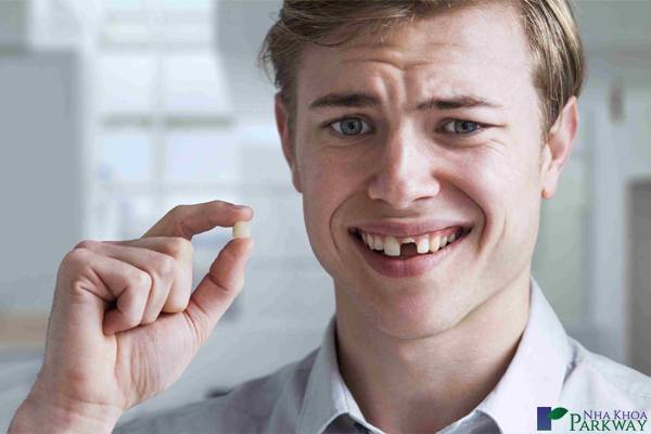 ai cần trồng răng Implant nha khoa parkway mất răng hàm gãy răng cửa gãy nửa răng cửa răng cửa gãy ngang