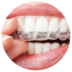 niềng răng invisalign pw