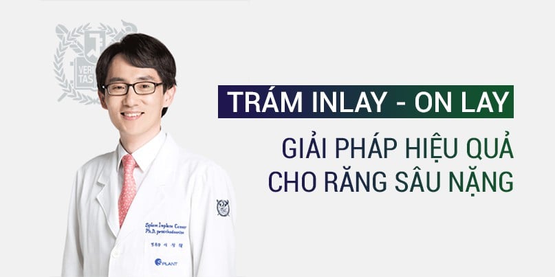 Image result for Phá»¥c há»i inlay onlay Æ°u ÄÃ£i