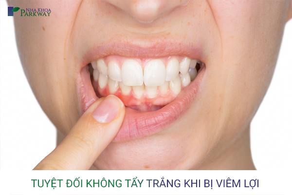 ko_tay_rang_khi_viem_loi