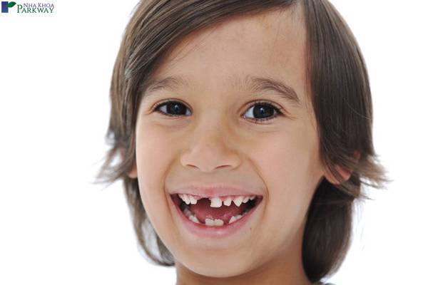 mất răng gãy răng gãy răng cửa mất răng hàm mất răng cửa