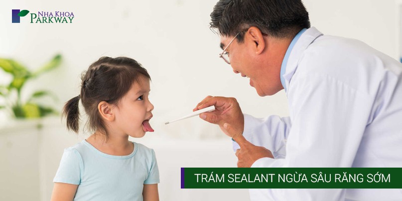Trám Sealant Ngừa Sâu Răng Sớm