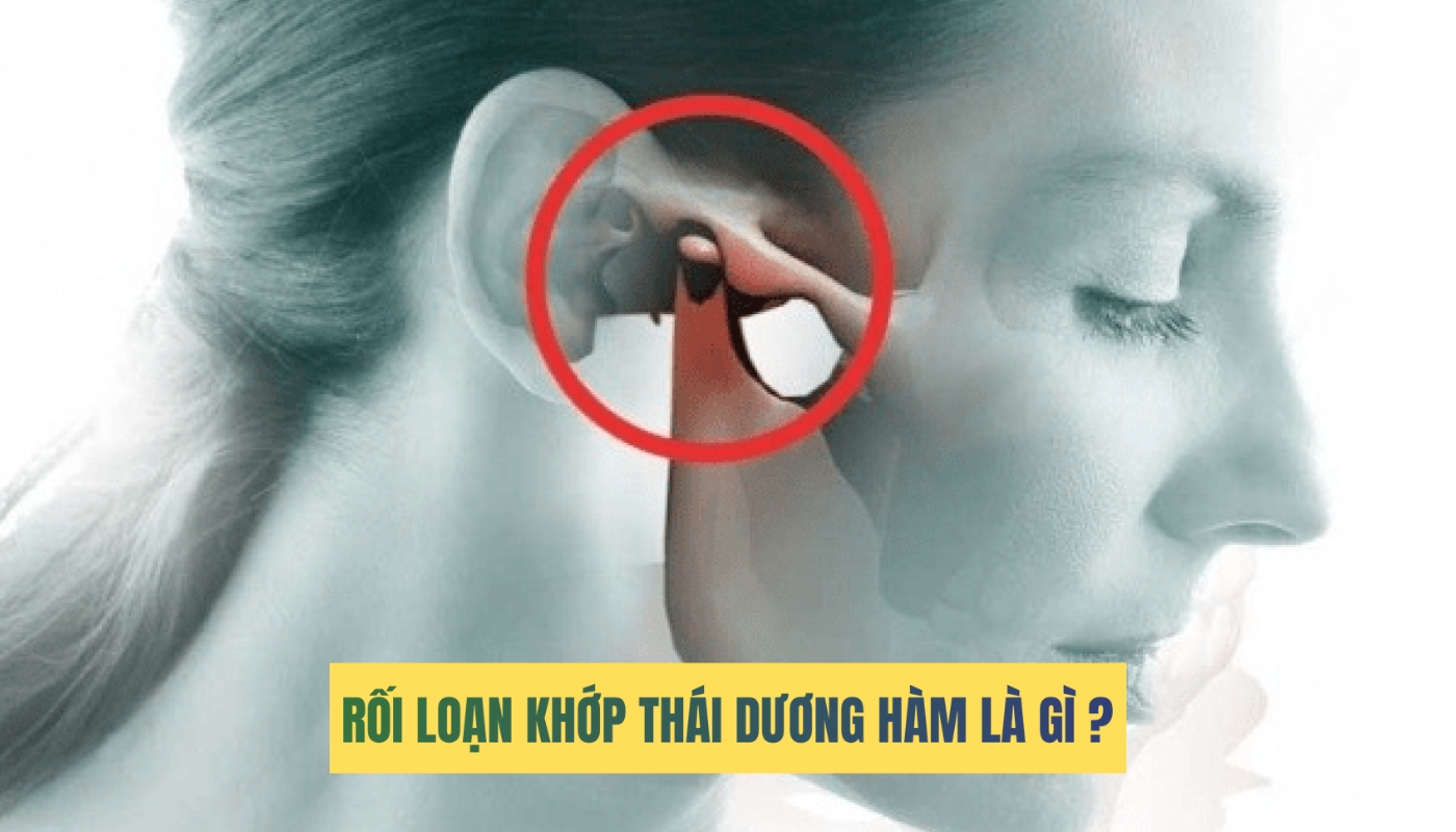 Rối loạn khớp thái dương hàm: Nguyên nhân, dấu hiệu và cách khắc phục