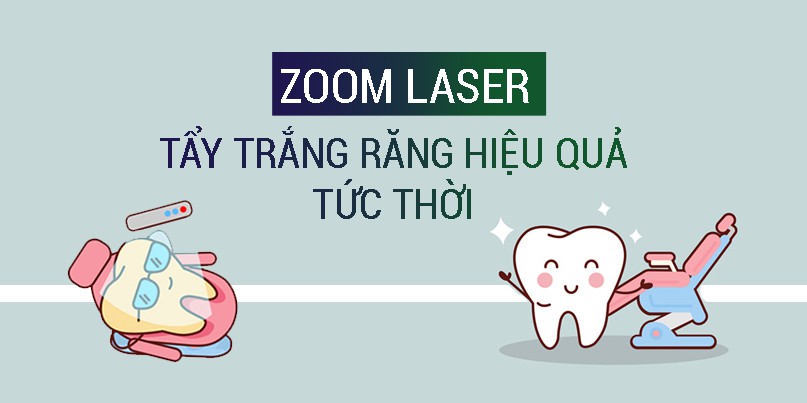 Tẩy trắng răng Zoom Laser