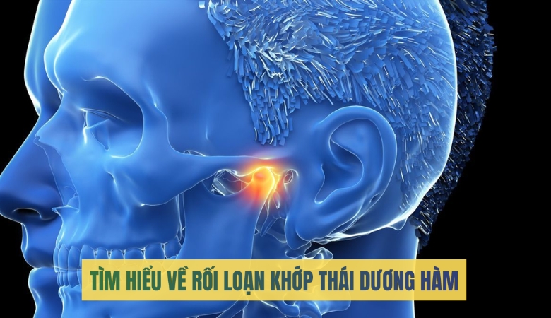 Tìm hiểu về rối loạn khớp thái dương hàm