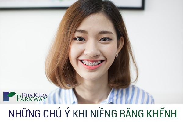 CHÚ_Ý_KHI_NIỀNG_RĂNG_KHỂNH
