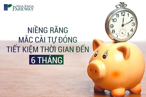 MẮC_CÀI_TỰ_BUỘC_TIẾT_KIỆM_THỜI_GIAN