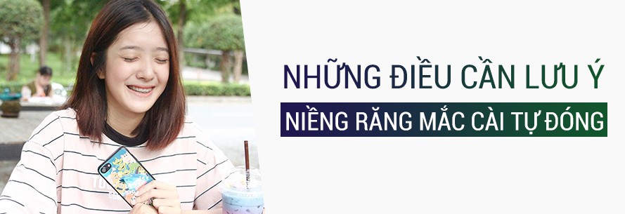 NIỀNG_RĂNG_MẮC_CÀI_TỰ_ĐÓNG_3