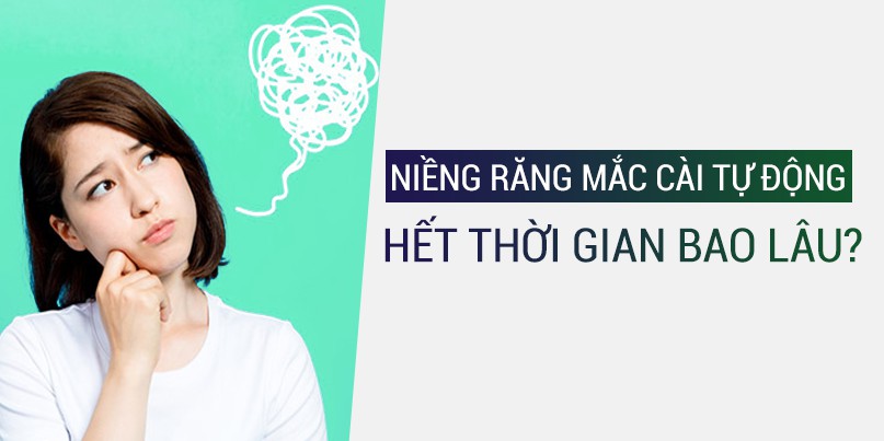 Niềng răng mắc cài tự động/tự đóng hết bao lâu?