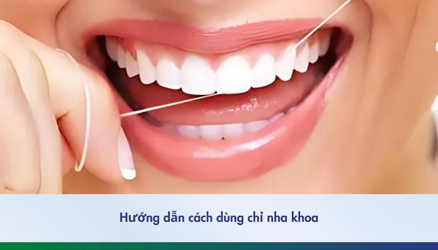 Cách dùng chỉ nha khoa