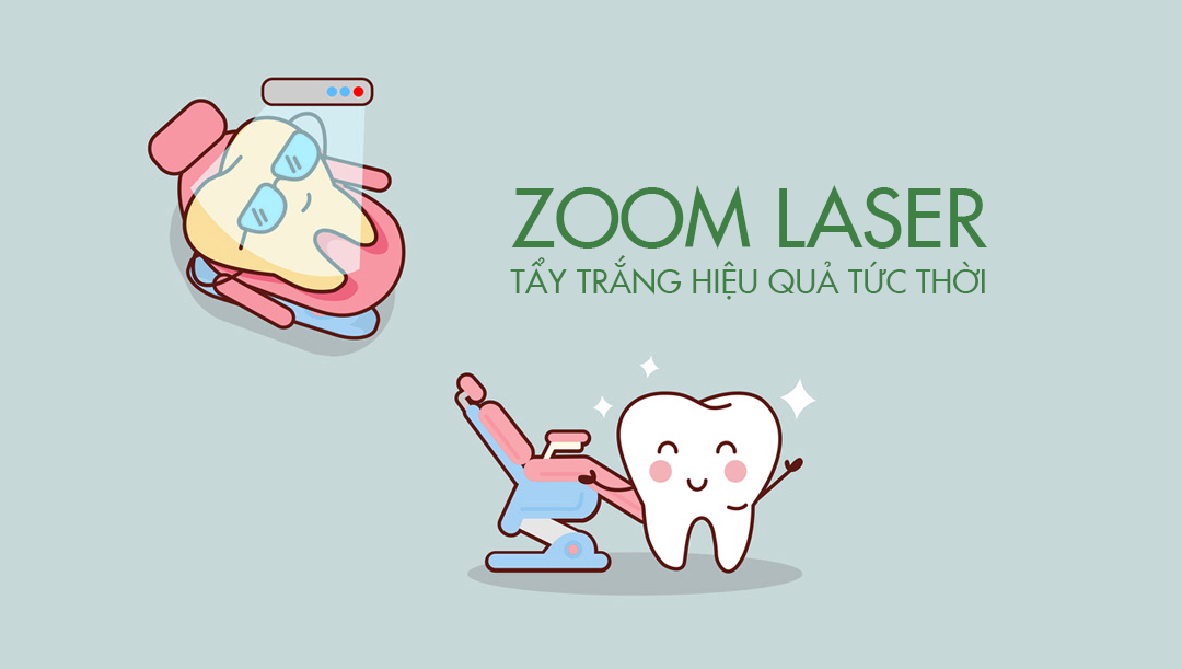 zoomlaser