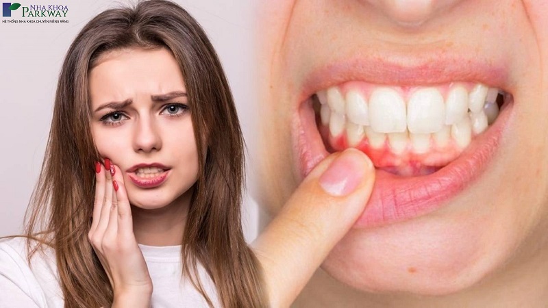 Chảy máu chân răng không cầm được là bệnh gì? Nguyên nhân do đâu?