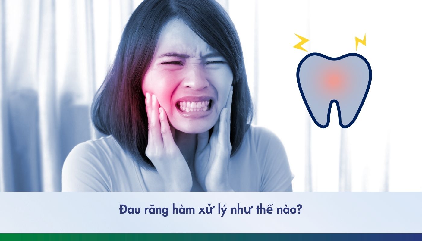 Nhức răng hàm chữa tại nhà hay cần đến nha sĩ