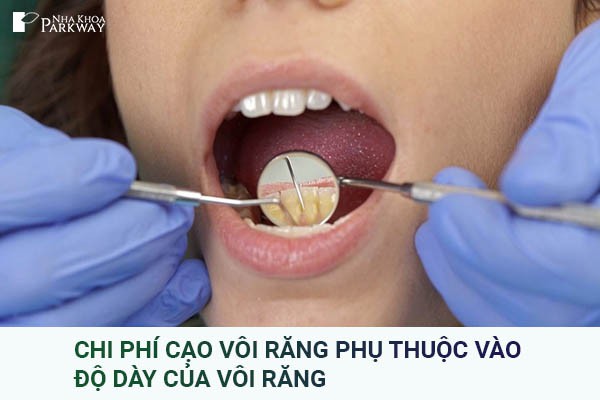 giá cạo vôi răng