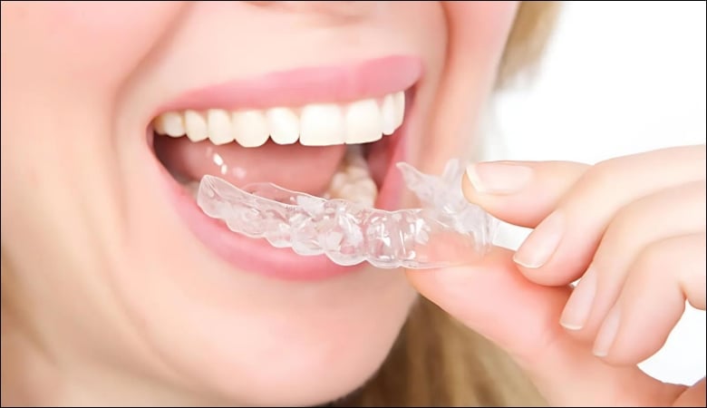 Người phụ nữ đang gắn khay niềng invisalign