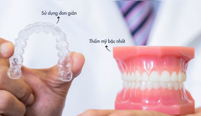 niềng răng tháo lắp invisalign