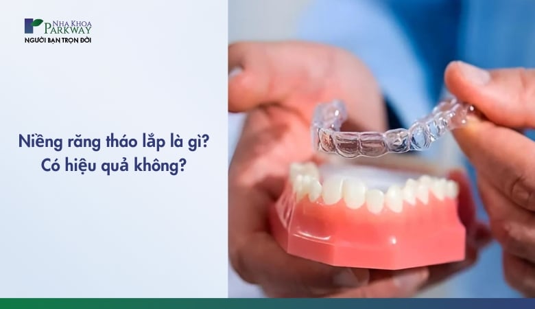 niềng răng tháo lắp là gì, Có hiệu quả không