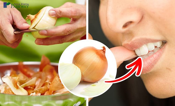cách giảm đau răng khôn