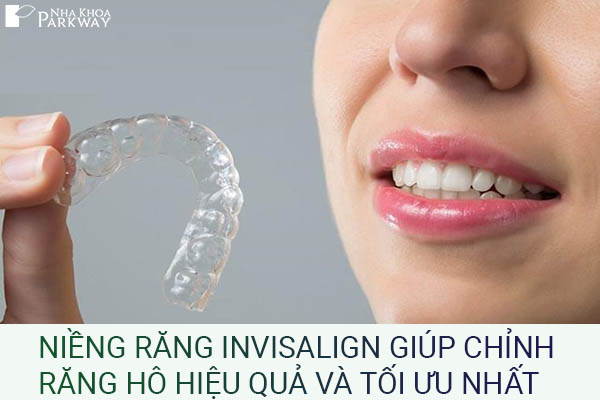 chỉnh răng hô bằng niềng răng trong suốt Invisalign