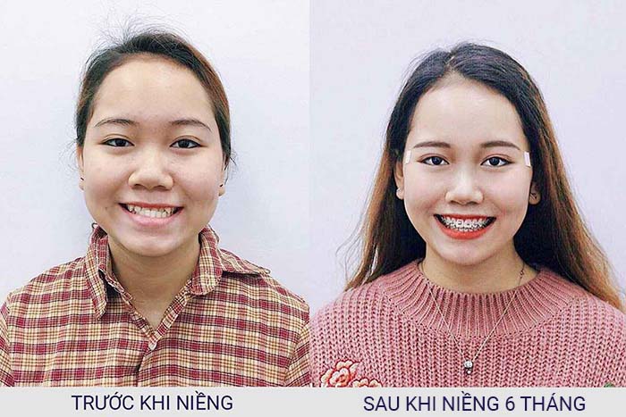 BÙI THỦY TIÊN-MÓM