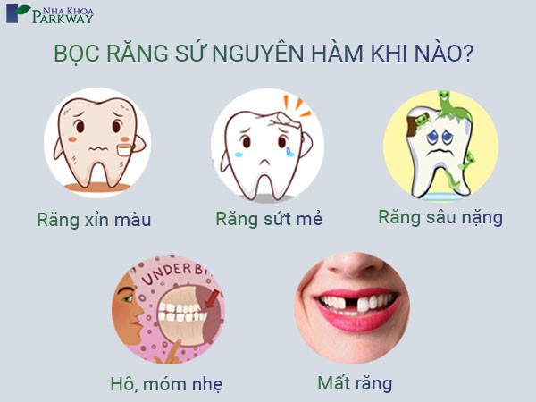 bọc răng sứ nguyên hàm khi nào