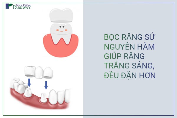 bọc răng sứ nguyên hàm là gì