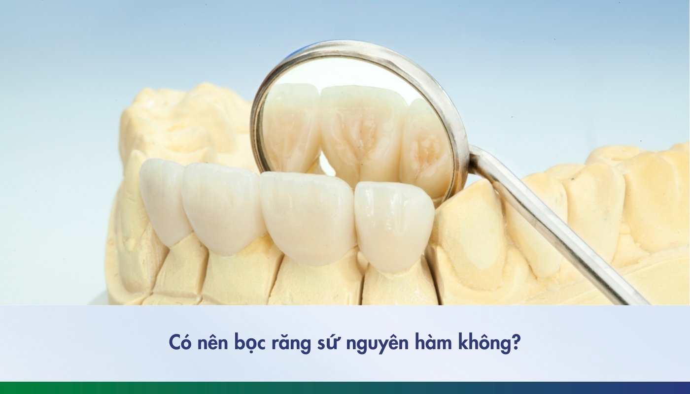 Có nên bọc răng sứ nguyên hàm? Giá bọc sứ bao nhiêu?