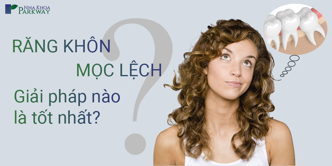 Các Trường Hợp Răng Khôn Mọc Lệch Và Hướng Xử Lý