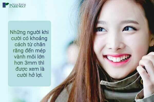 cười hở lợi