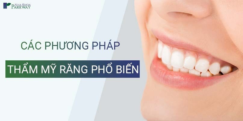 Các Phương Pháp Thẩm Mỹ Răng Phổ Biến
