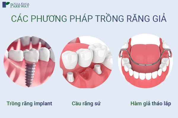 trồng răng giả