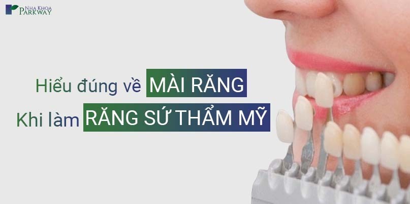 Hiểu Đúng Về Mài Răng Khi Làm Răng Sứ Thẩm Mỹ