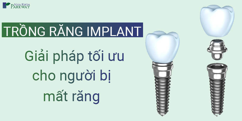trồng răng implant