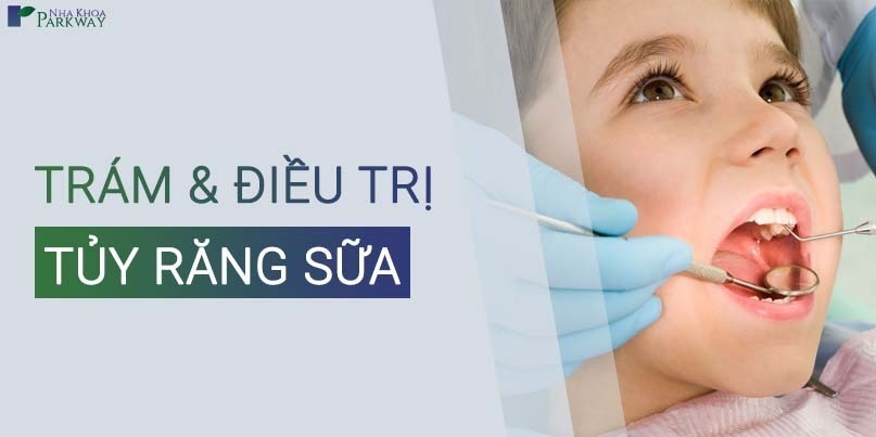 Trám Và Điều Trị Tuỷ Răng Sữa